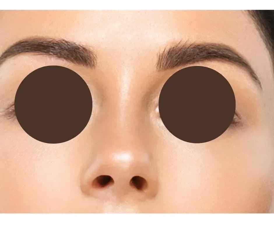 Eye relax